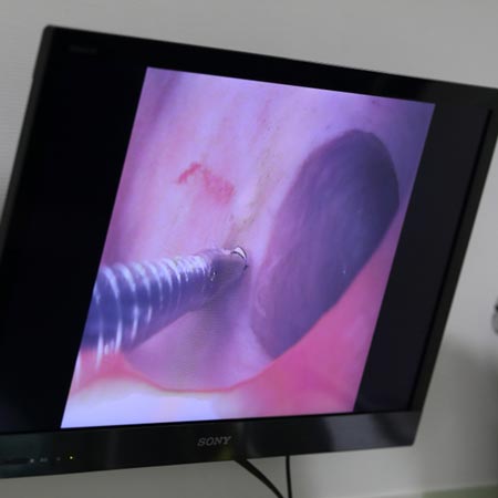 Techniques d'endoscopie vétérinaire - place au diagnostique mini invasif